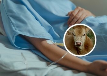 Kasus Pertama di Dunia, Virus Shamonda yang Menginfeksi Sapi Ditemukan Menular ke Manusia di Perancis