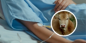 Kasus Pertama di Dunia, Virus Shamonda yang Menginfeksi Sapi Ditemukan Menular ke Manusia di Perancis